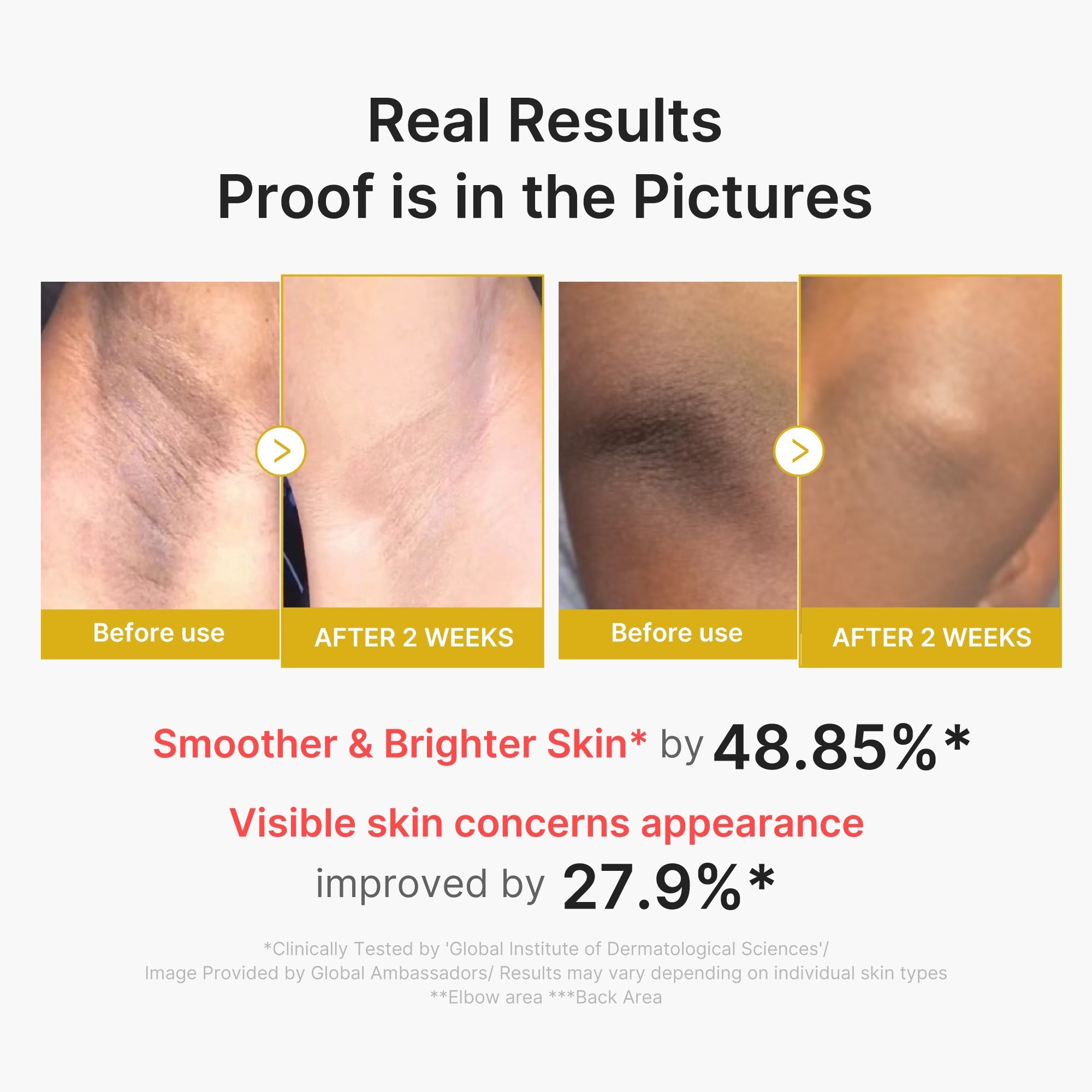Kojic Acid Turmeric Body Peel Shot