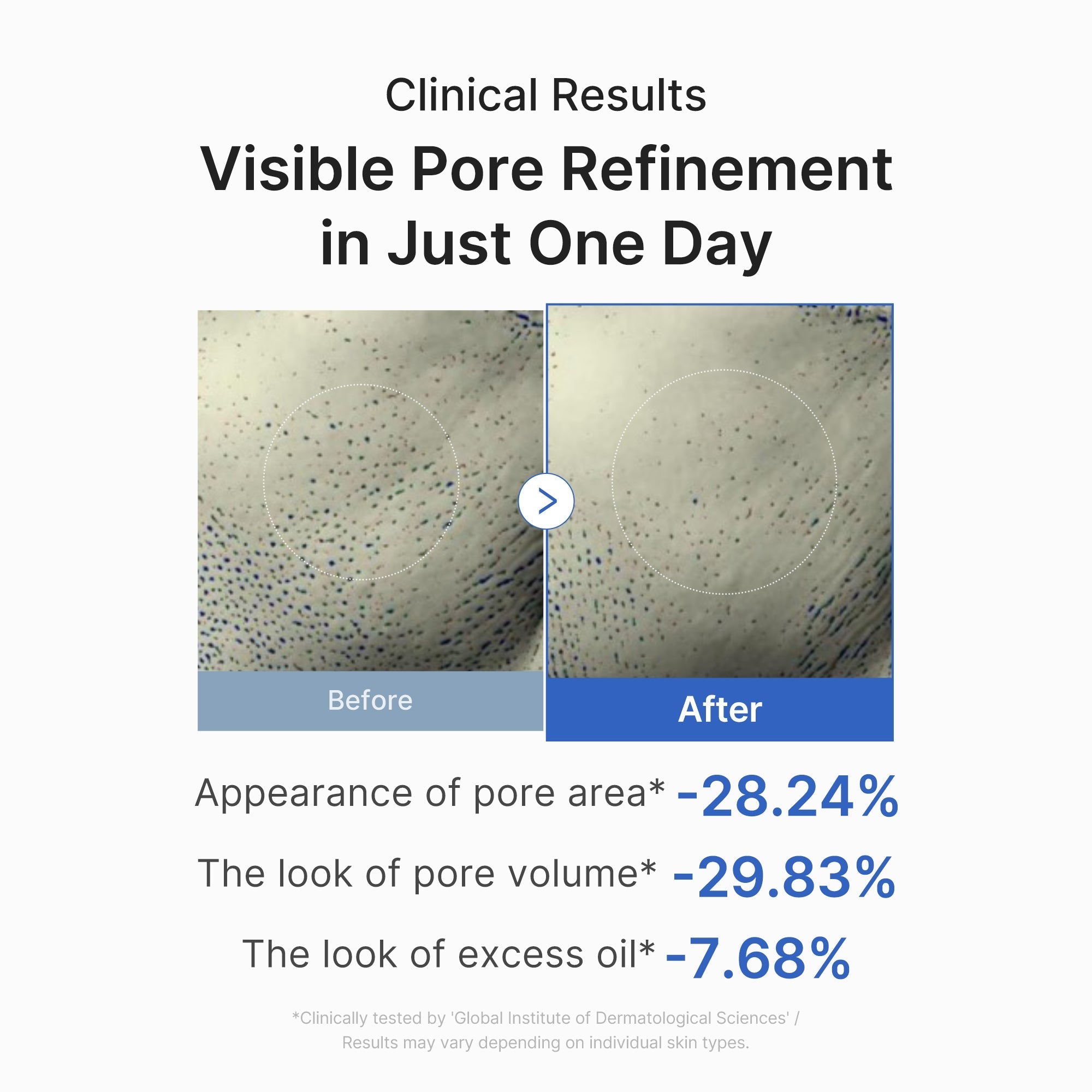 Zero Pore One-day Peptide Serum
