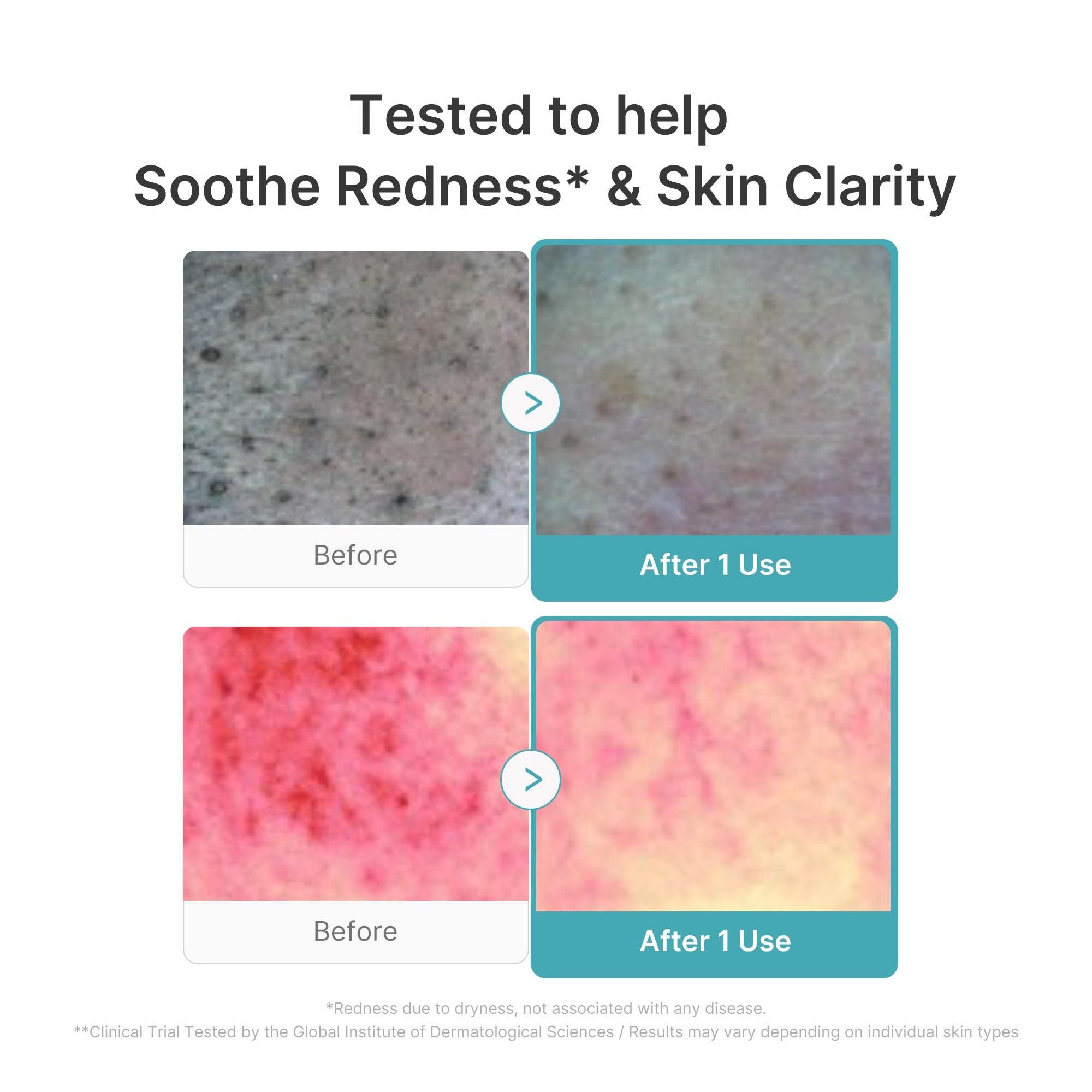 Azelaic Acid Capsule Foam Cleanser